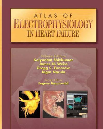 Cover image for Atlas of Electrophysiology in Heart Failure