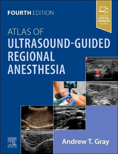 Cover image for Atlas of Ultrasound-Guided Regional Anesthesia