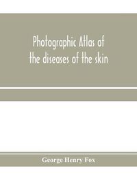 Cover image for Photographic atlas of the diseases of the skin; A Series of Eighty Plates, Comprising more than One Hundred Illustrations, with Descriptive text, and a Treatise on Cutaneous Therapeutics