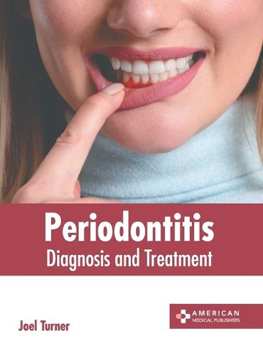 Cover image for Periodontitis: Diagnosis and Treatment