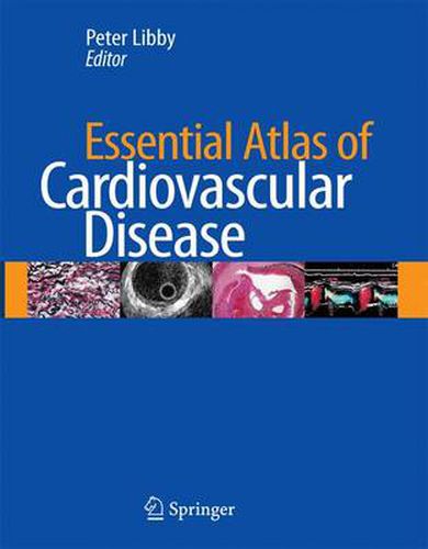 Cover image for Essential Atlas of Cardiovascular Disease