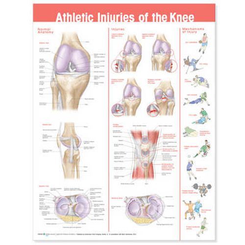 Cover image for Athletic Injuries of the Knee Anatomical Chart