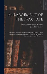 Cover image for Enlargement of the Prostate