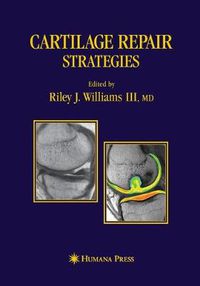 Cover image for Cartilage Repair Strategies