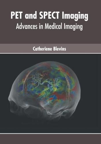 Cover image for Pet and Spect Imaging: Advances in Medical Imaging