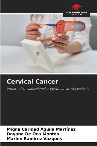 Cover image for Cervical Cancer