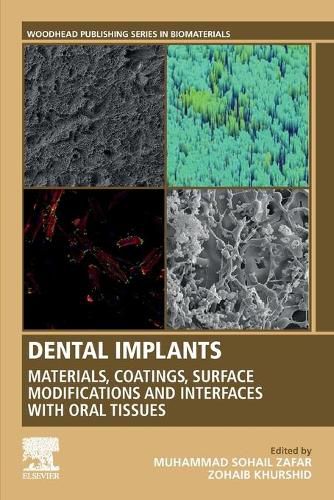 Cover image for Dental Implants: Materials, Coatings, Surface Modifications and Interfaces with Oral Tissues