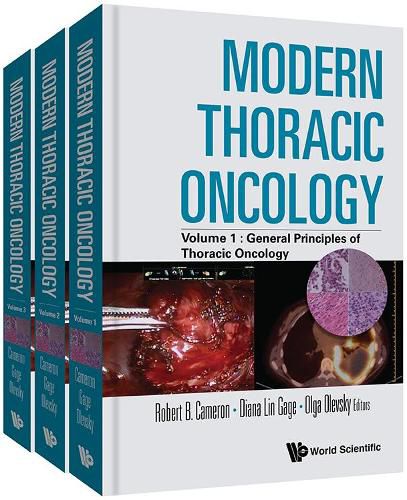 Cover image for Modern Thoracic Oncology (In 3 Volumes)