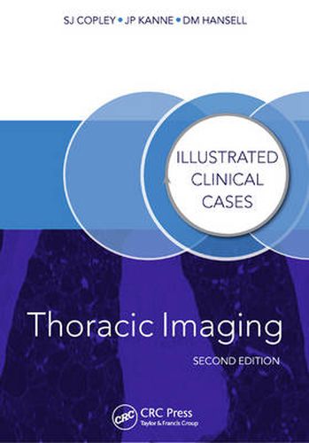 Cover image for Thoracic Imaging: Illustrated Clinical Cases