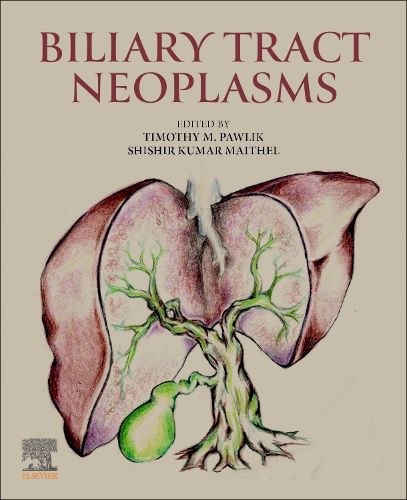 Cover image for Biliary Tract Neoplasms