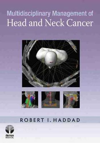 Cover image for Multidisciplinary Management of Head and Neck Cancer