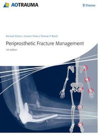 Cover image for Periprosthetic Fracture Management