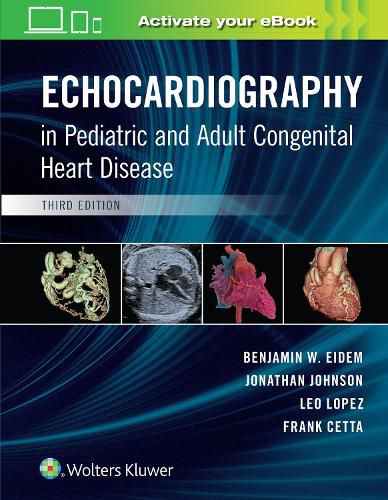 Cover image for Echocardiography in Pediatric and Adult Congenital Heart Disease