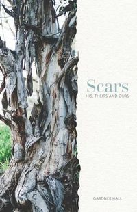 Cover image for Scars: His, Theirs and Ours