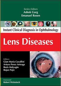 Cover image for Lens Diseases