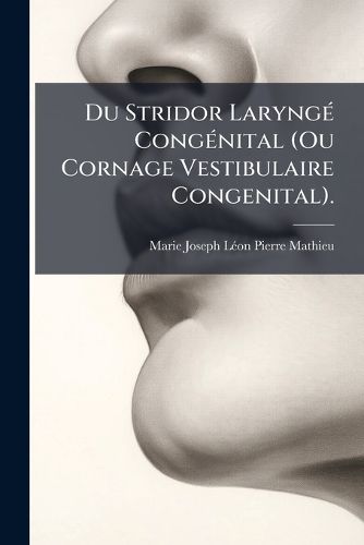 Cover image for Du Stridor Laryng Congnital (Ou Cornage Vestibulaire Congenital).