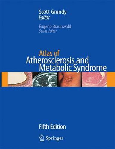 Cover image for Atlas of Atherosclerosis and Metabolic Syndrome