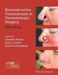 Cover image for Reconstructive Conundrums in Dermatologic Surgery - The Nose