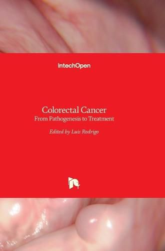 Cover image for Colorectal Cancer: From Pathogenesis to Treatment