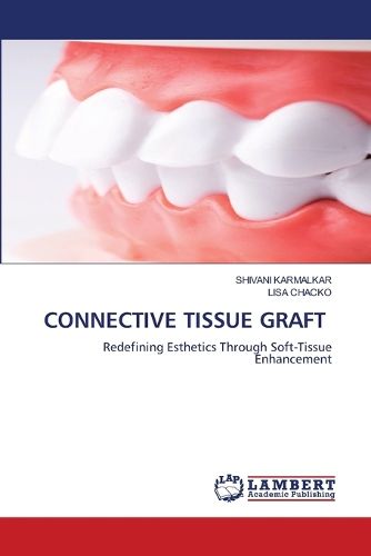 Cover image for Connective Tissue Graft