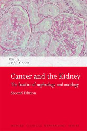 Cover image for Cancer and the Kidney: The frontier of nephrology and oncology