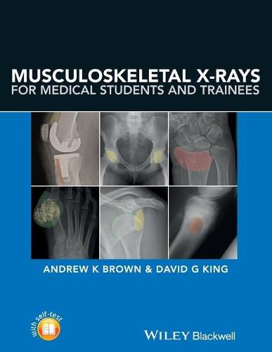 Musculoskeletal X-rays for Medical Students