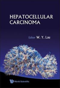 Cover image for Hepatocellular Carcinoma