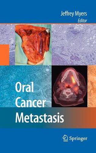 Cover image for Oral Cancer Metastasis