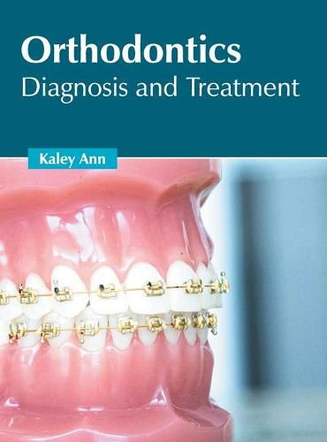 Cover image for Orthodontics: Diagnosis and Treatment