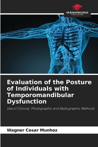 Cover image for Evaluation of the Posture of Individuals with Temporomandibular Dysfunction