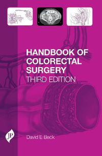 Cover image for Handbook of Colorectal Surgery: Third Edition