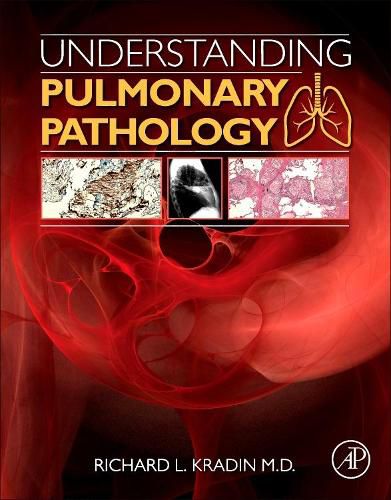 Understanding Pulmonary Pathology: Applying Pathological Findings in Therapeutic Decision Making