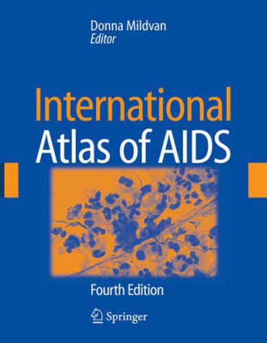 Cover image for International Atlas of AIDS