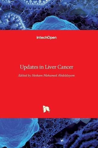 Cover image for Updates in Liver Cancer