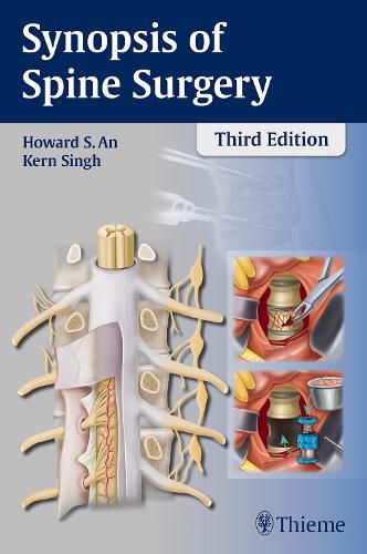 Cover image for Synopsis of Spine Surgery