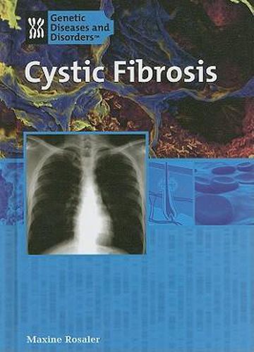 Cover image for Cystic Fibrosis