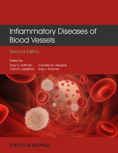 Cover image for Inflammatory Diseases of Blood Vessels