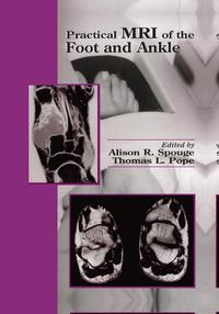 Cover image for Practical MRI of the Foot and Ankle