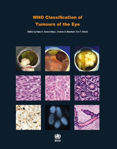 Cover image for WHO Classification of Tumours of the Eye: WHO Classification of Tumours, Volume 12