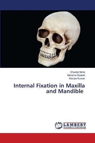 Cover image for Internal Fixation in Maxilla and Mandible