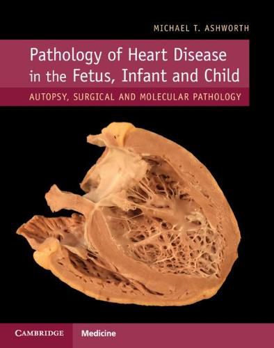 Cover image for Pathology of Heart Disease in the Fetus, Infant and Child: Autopsy, Surgical and Molecular Pathology