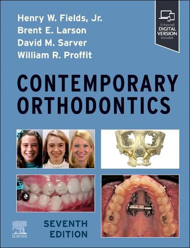 Cover image for Contemporary Orthodontics