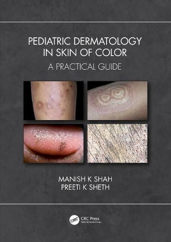 Cover image for Pediatric Dermatology in Skin of Color: A Practical Guide