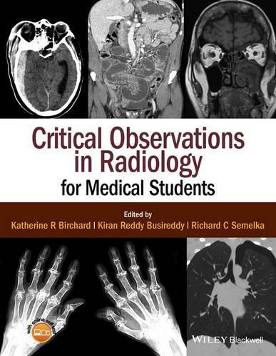 Cover image for Critical Observations in Radiology for Medical Students