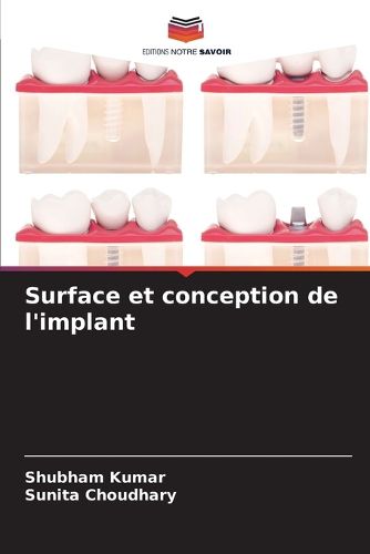 Cover image for Surface et conception de l'implant