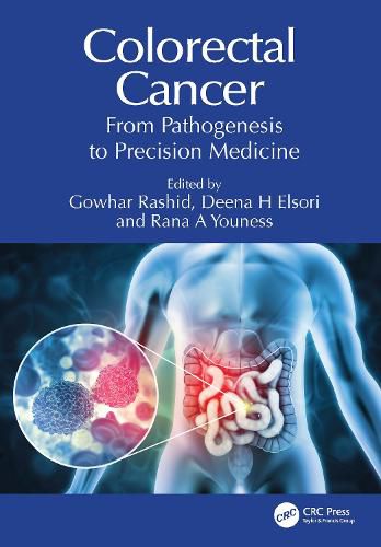 Cover image for Colorectal Cancer