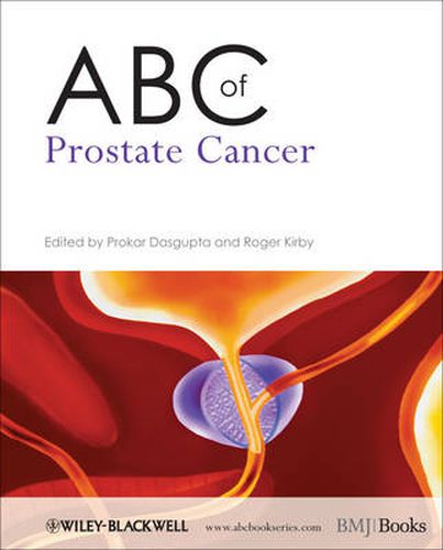 Cover image for ABC of Prostate Cancer