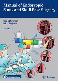 Cover image for Manual of Endoscopic Sinus and Skull Base Surgery