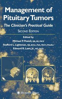 Cover image for Management of Pituitary Tumors: The Clinician's Practical Guide