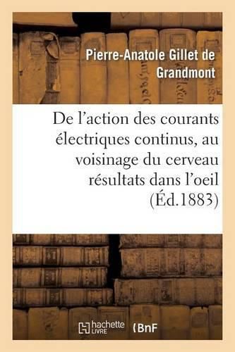 Action Des Courants Electriques Continus Appliques Au Voisinage Du Cerveau, Resultats Dans l'Oeil